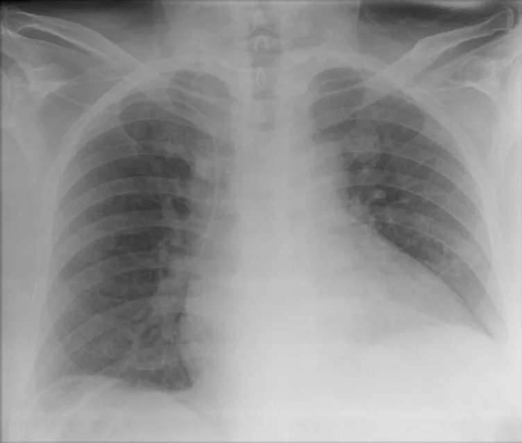 Abdomen radiograph for self-assessment