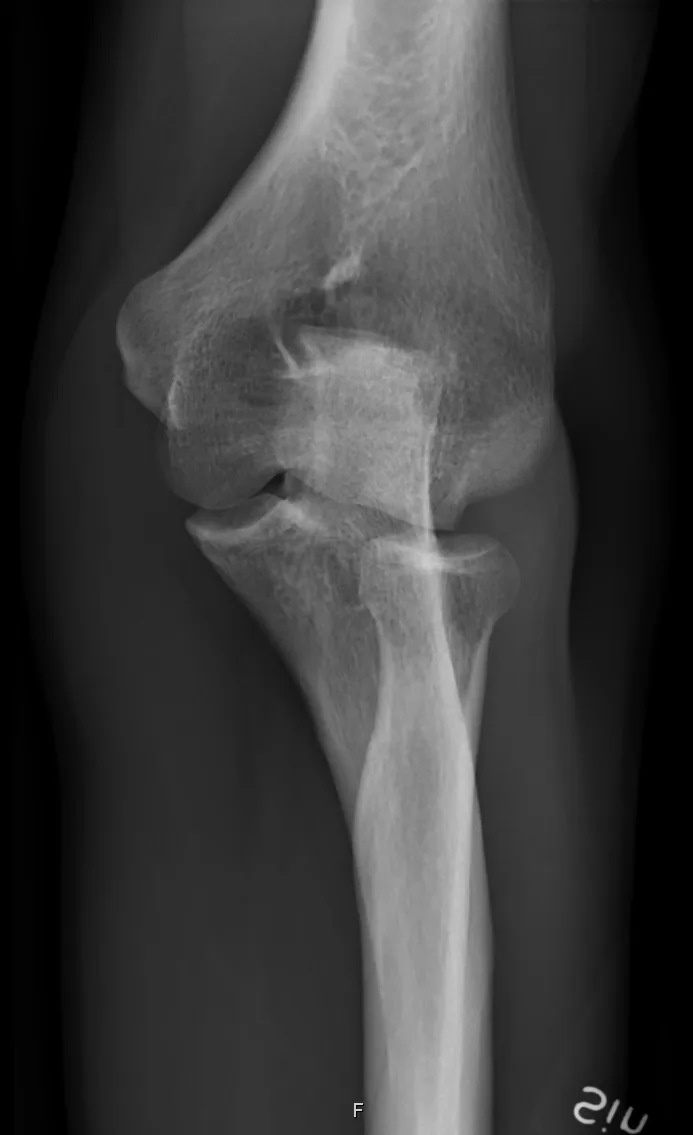 Upper limb radiograph for self-assessment
