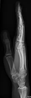Radiograph from the case bank: Normal hand radiograph