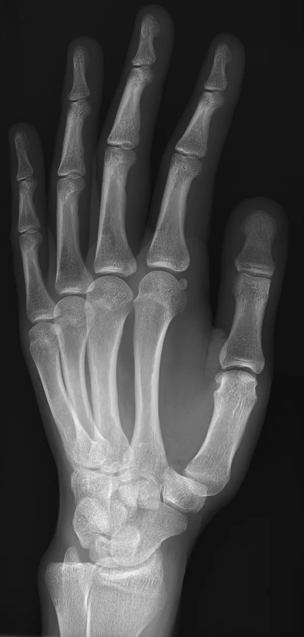 Upper limb radiograph for self-assessment