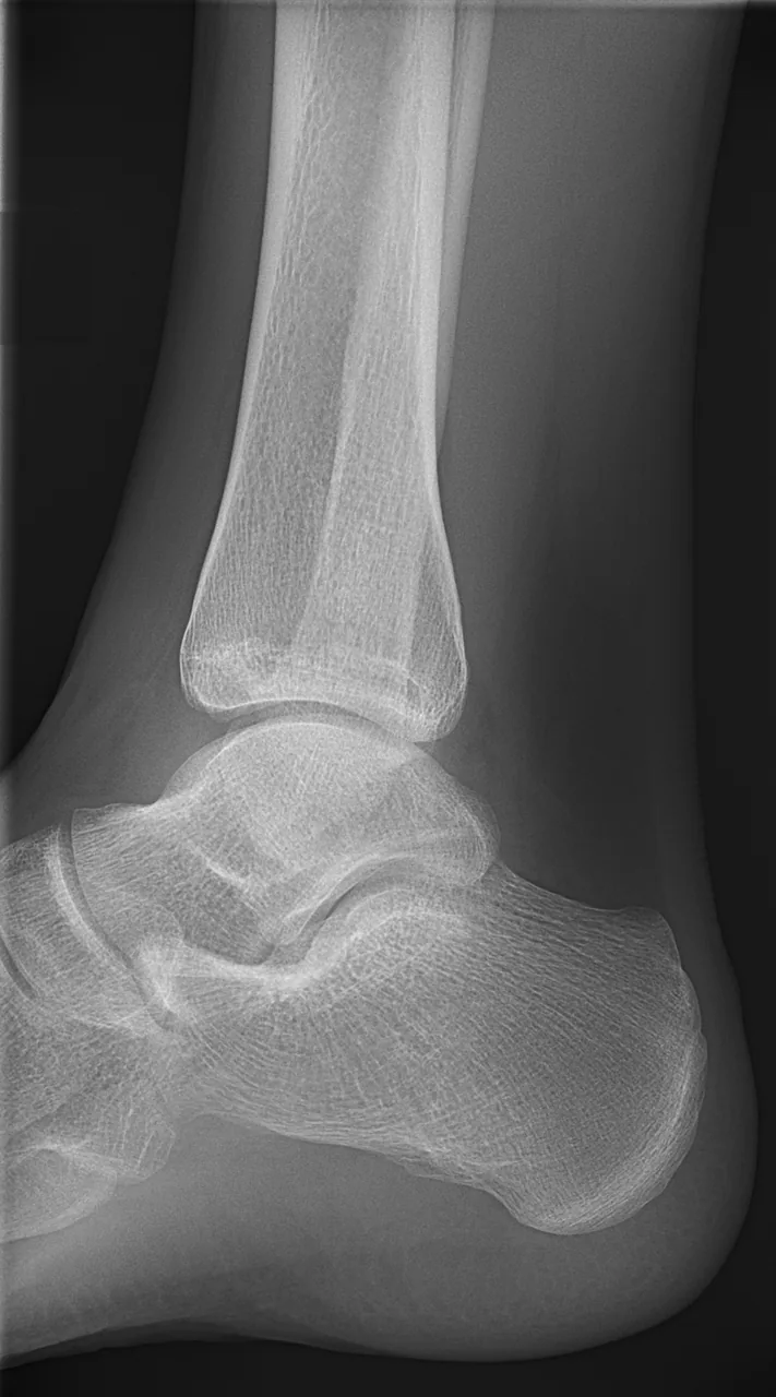Lower limb radiograph for self-assessment
