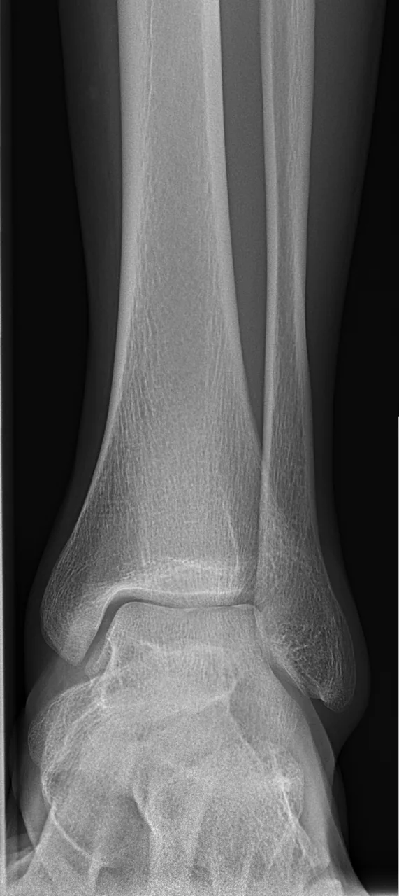 Lower limb radiograph for self-assessment
