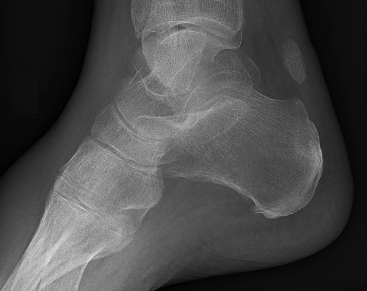 Lower limb radiograph for self-assessment
