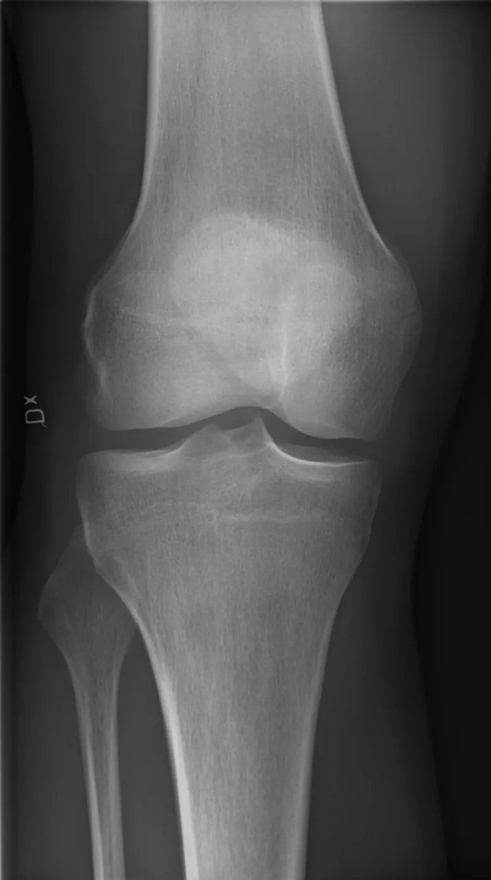 Lower limb radiograph for self-assessment