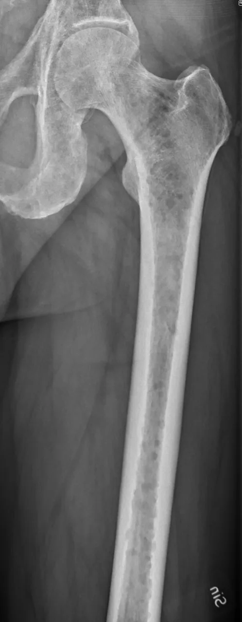 Bone & joint disease radiograph for self-assessment