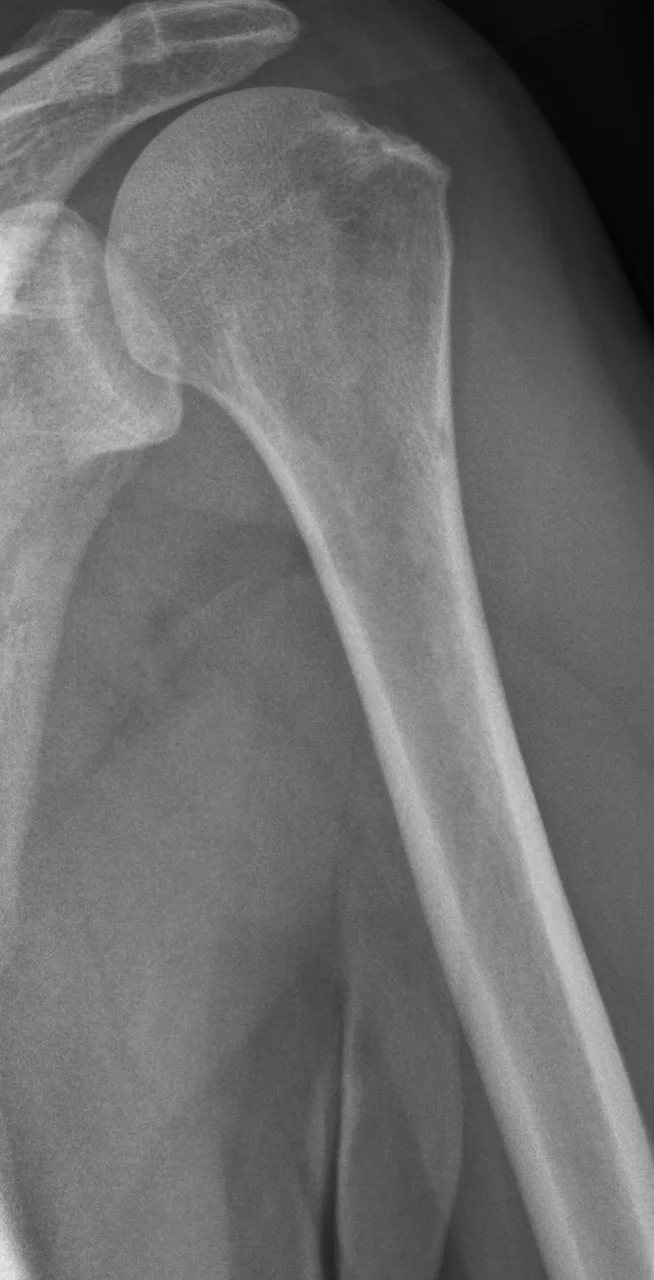 Bone & joint disease radiograph for self-assessment