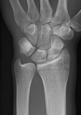 Radiograph from the case bank: Normal wrist radiograph