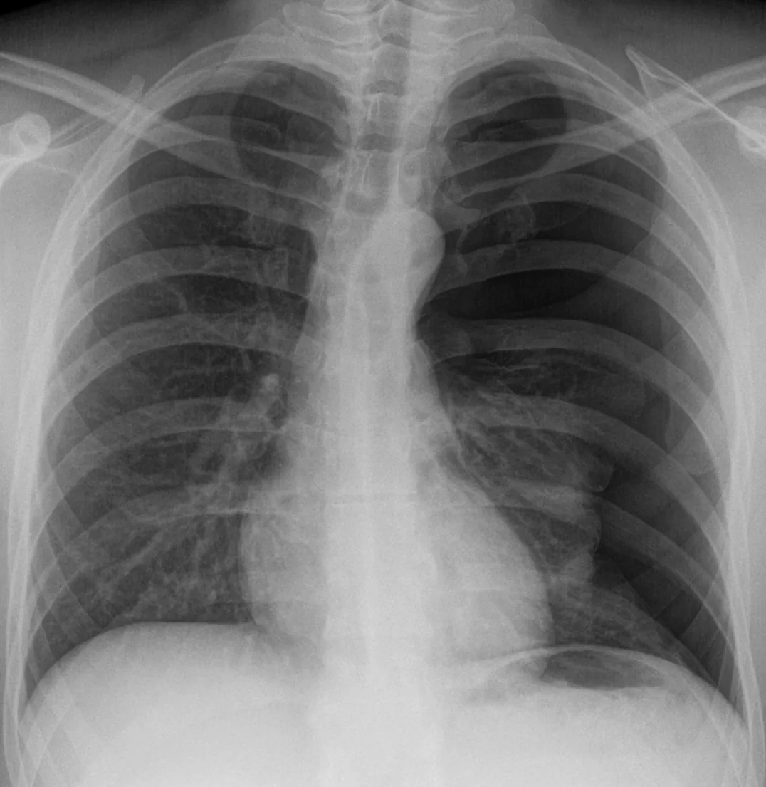 Chest radiograph for self-assessment