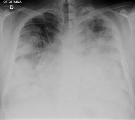 Chest radiograph for self-assessment