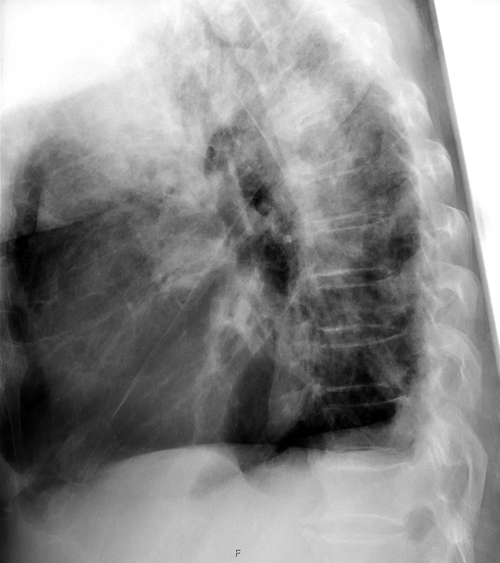 Chest radiograph for self-assessment
