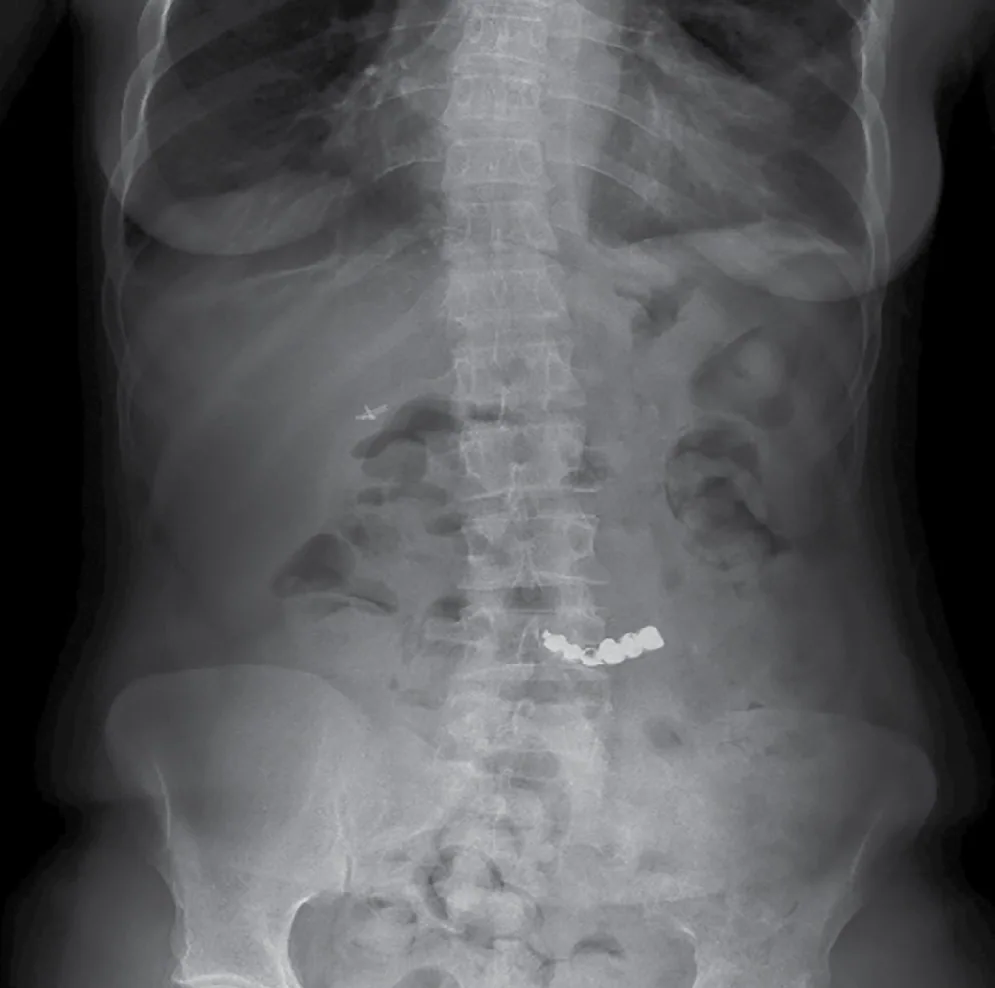 Abdomen radiograph for self-assessment