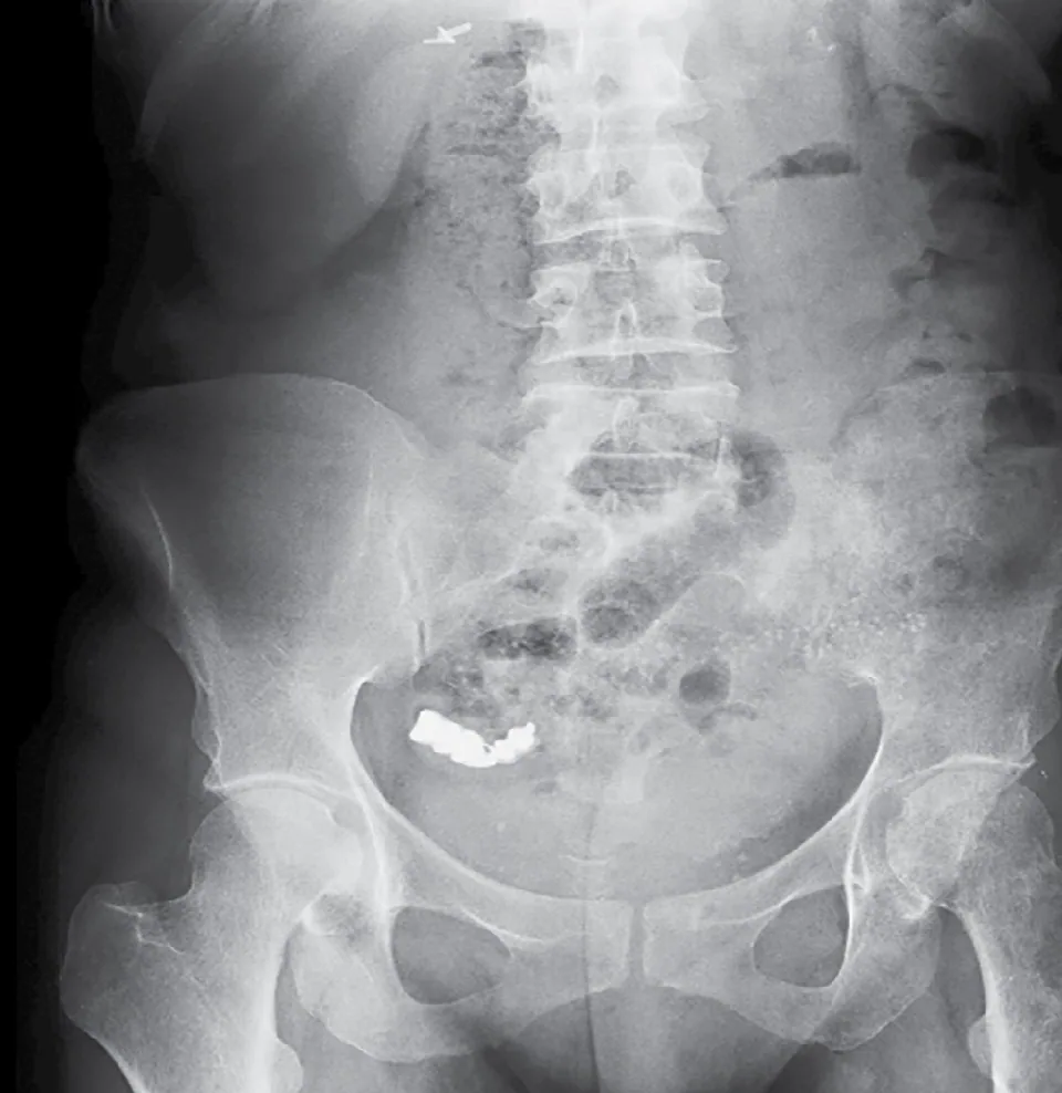 Abdomen radiograph for self-assessment
