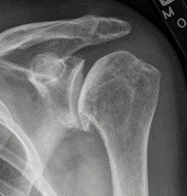 Bone & joint disease radiograph for self-assessment