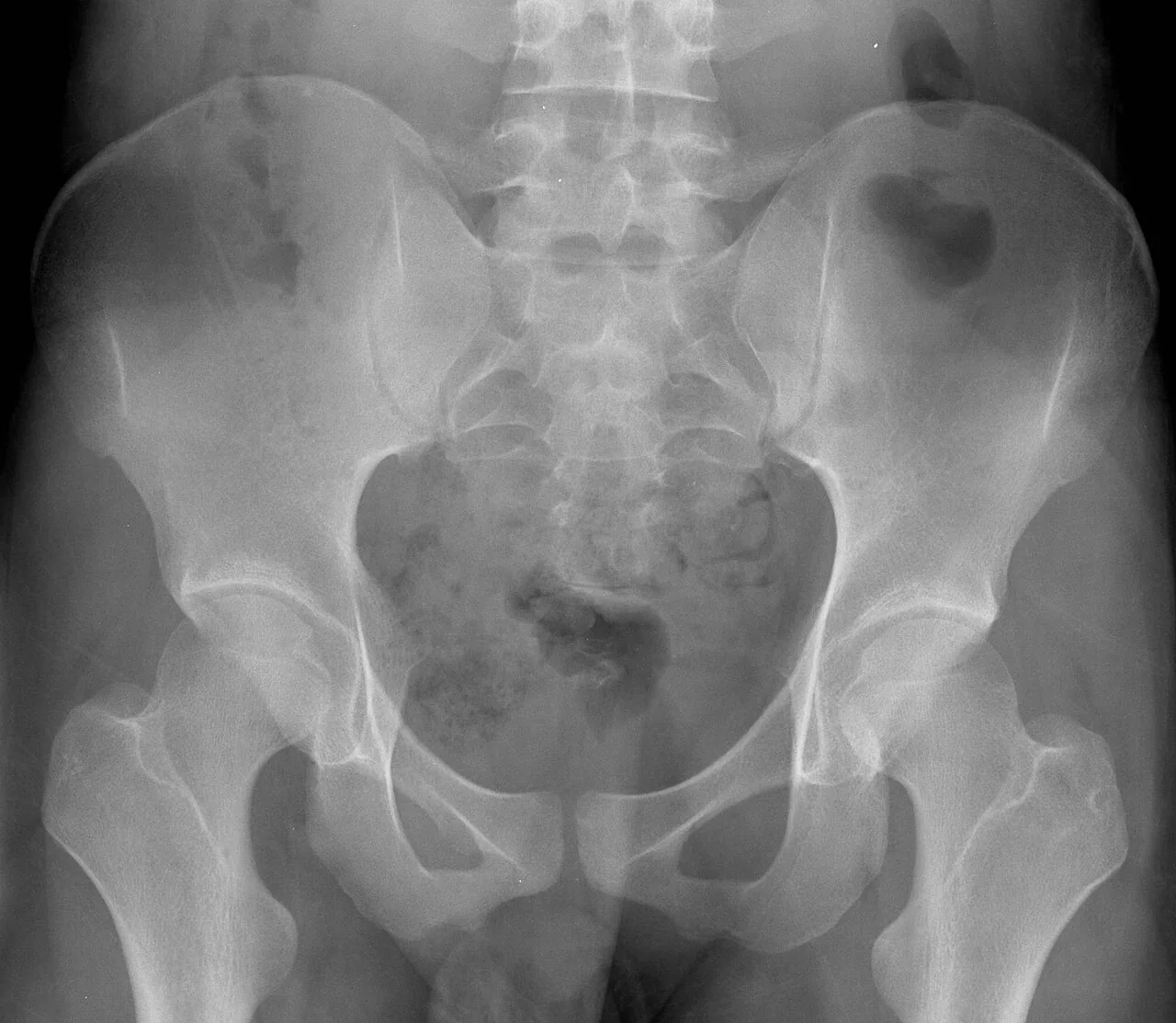 Lower limb radiograph for self-assessment