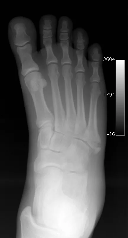 Lower limb radiograph for self-assessment