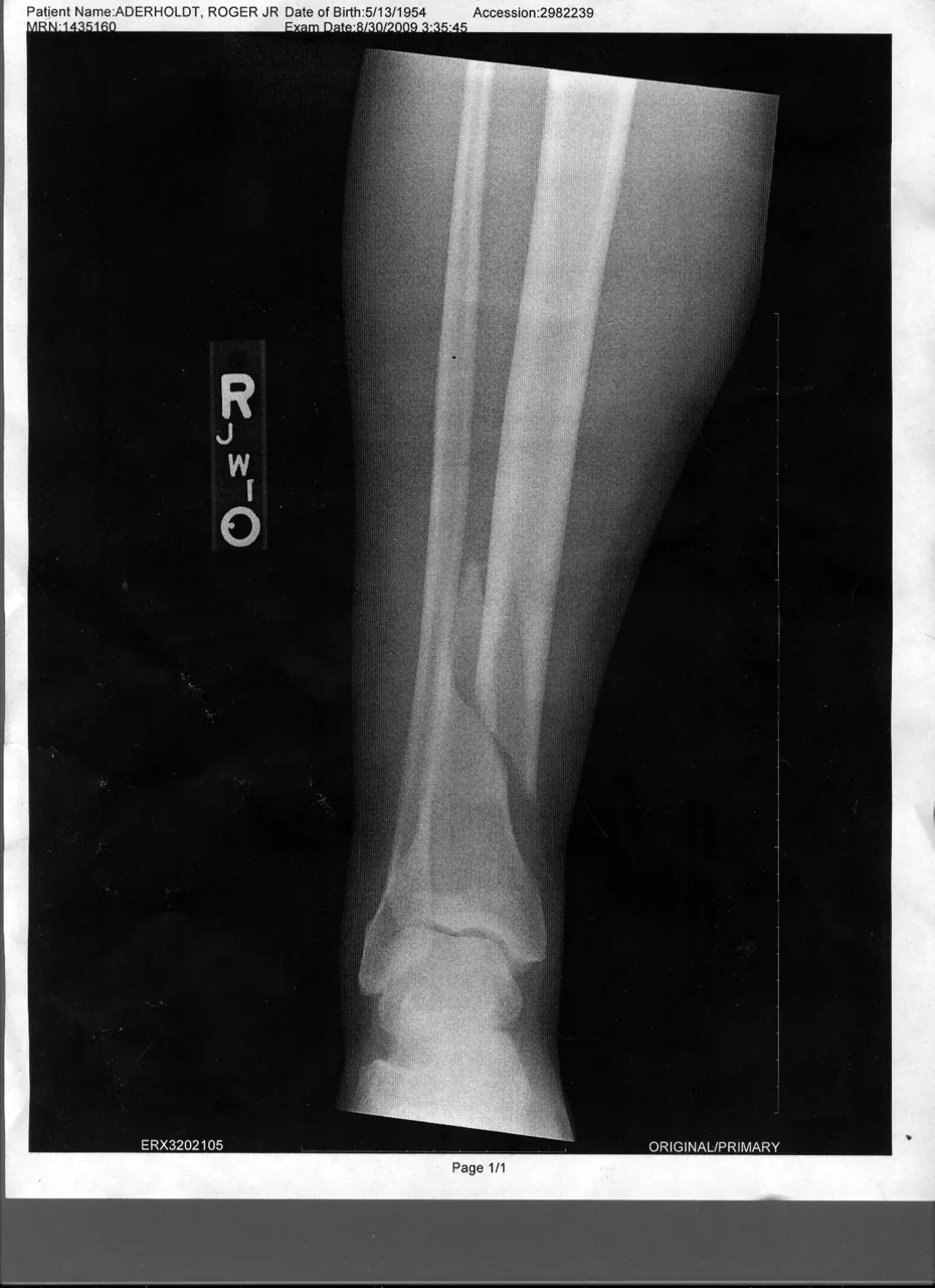 Lower limb radiograph for self-assessment