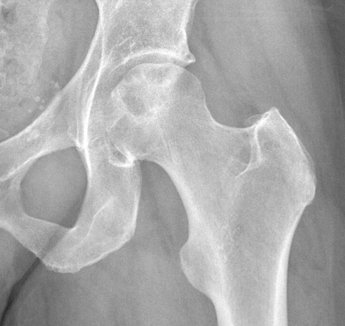 Bone & joint disease radiograph for self-assessment