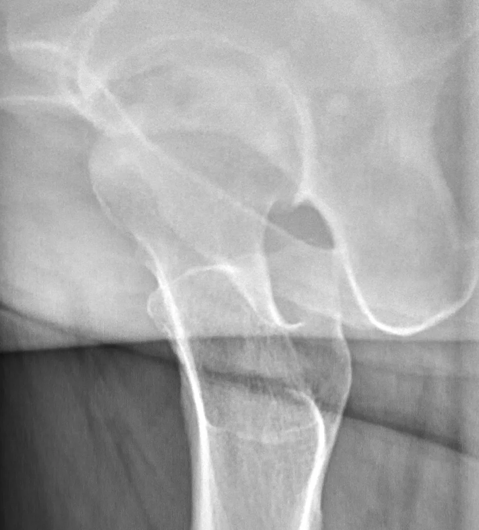Bone & joint disease radiograph for self-assessment
