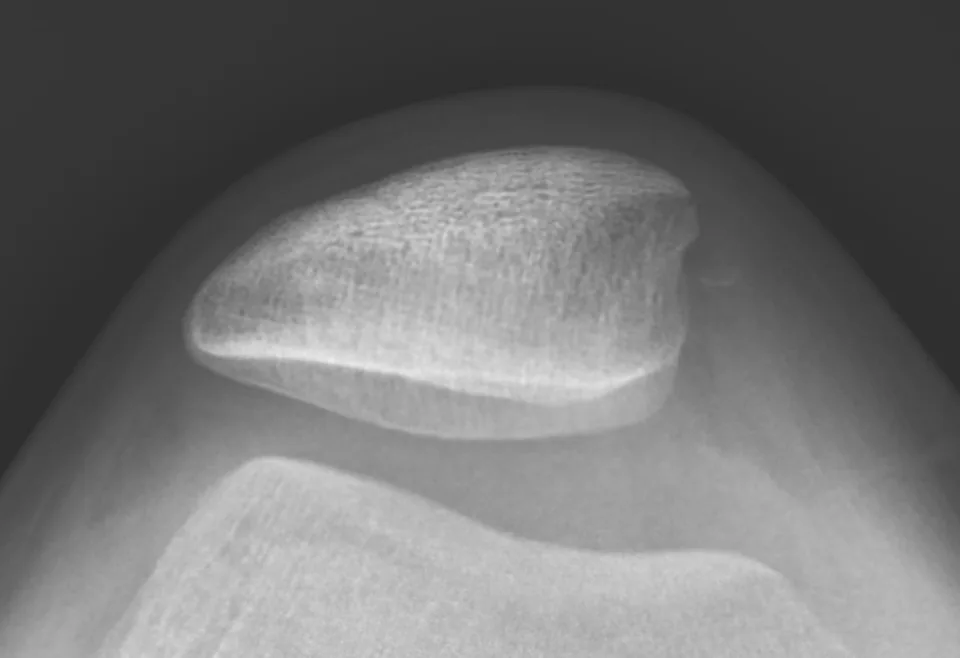 Lower limb radiograph for self-assessment