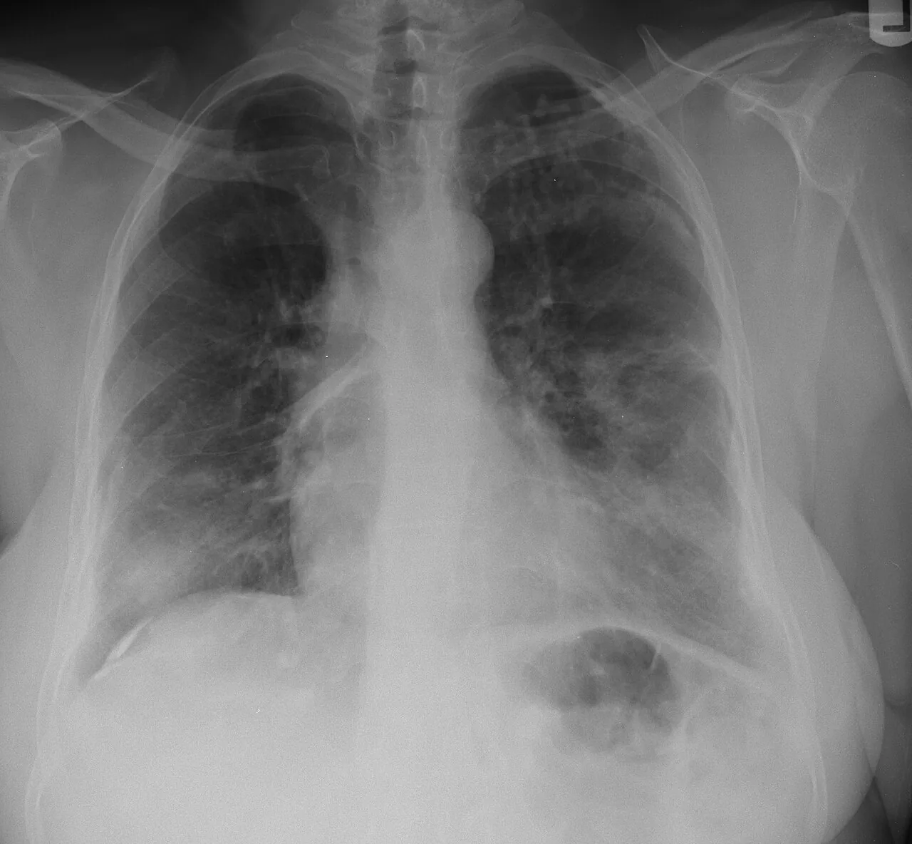 Chest radiograph for self-assessment