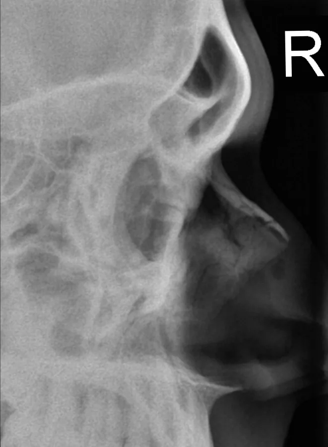 Skull & face radiograph for self-assessment