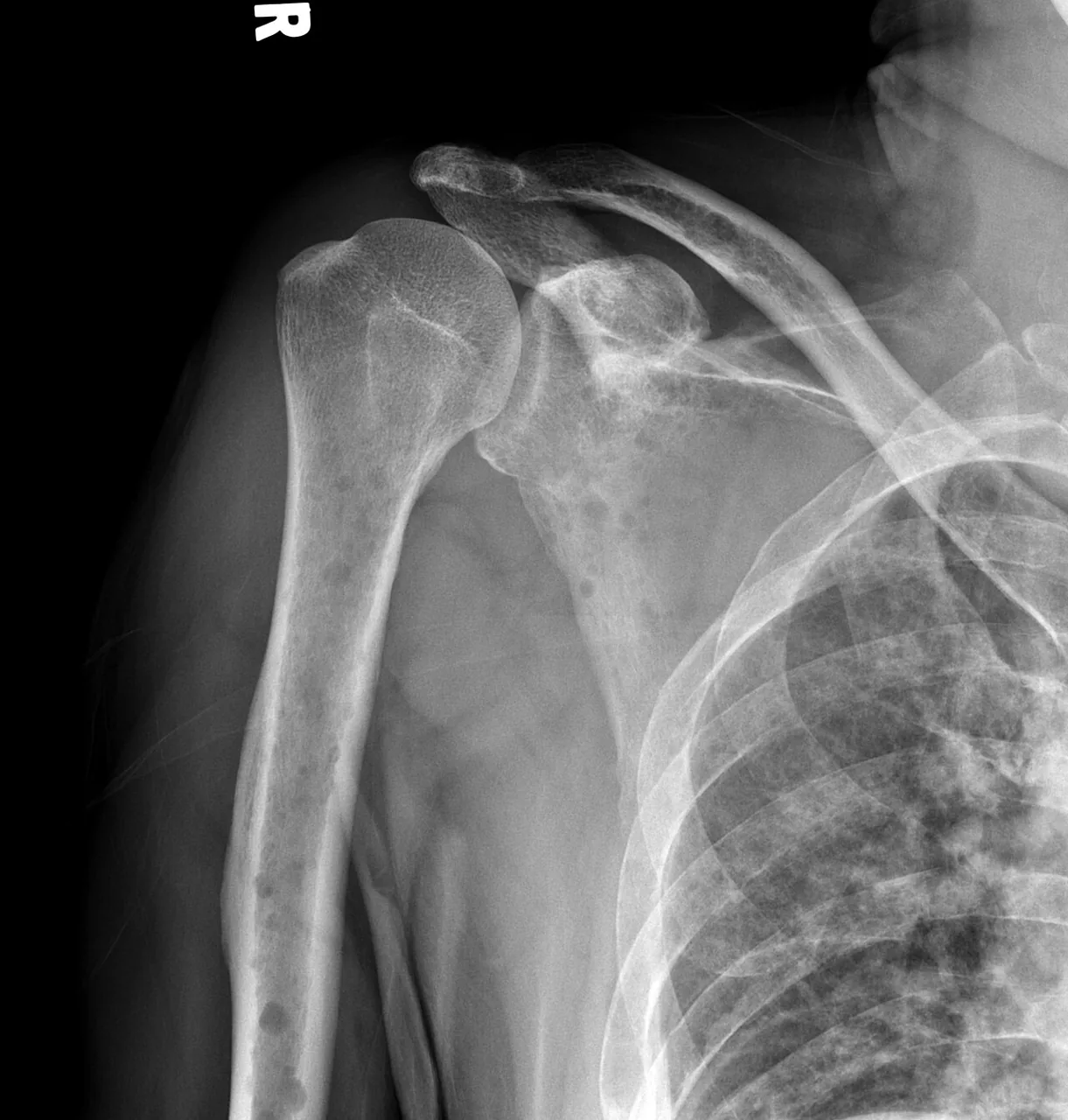 Bone & joint disease radiograph for self-assessment