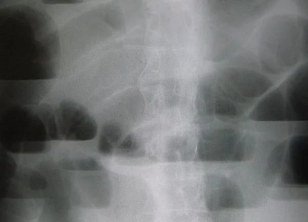 Abdomen radiograph for self-assessment