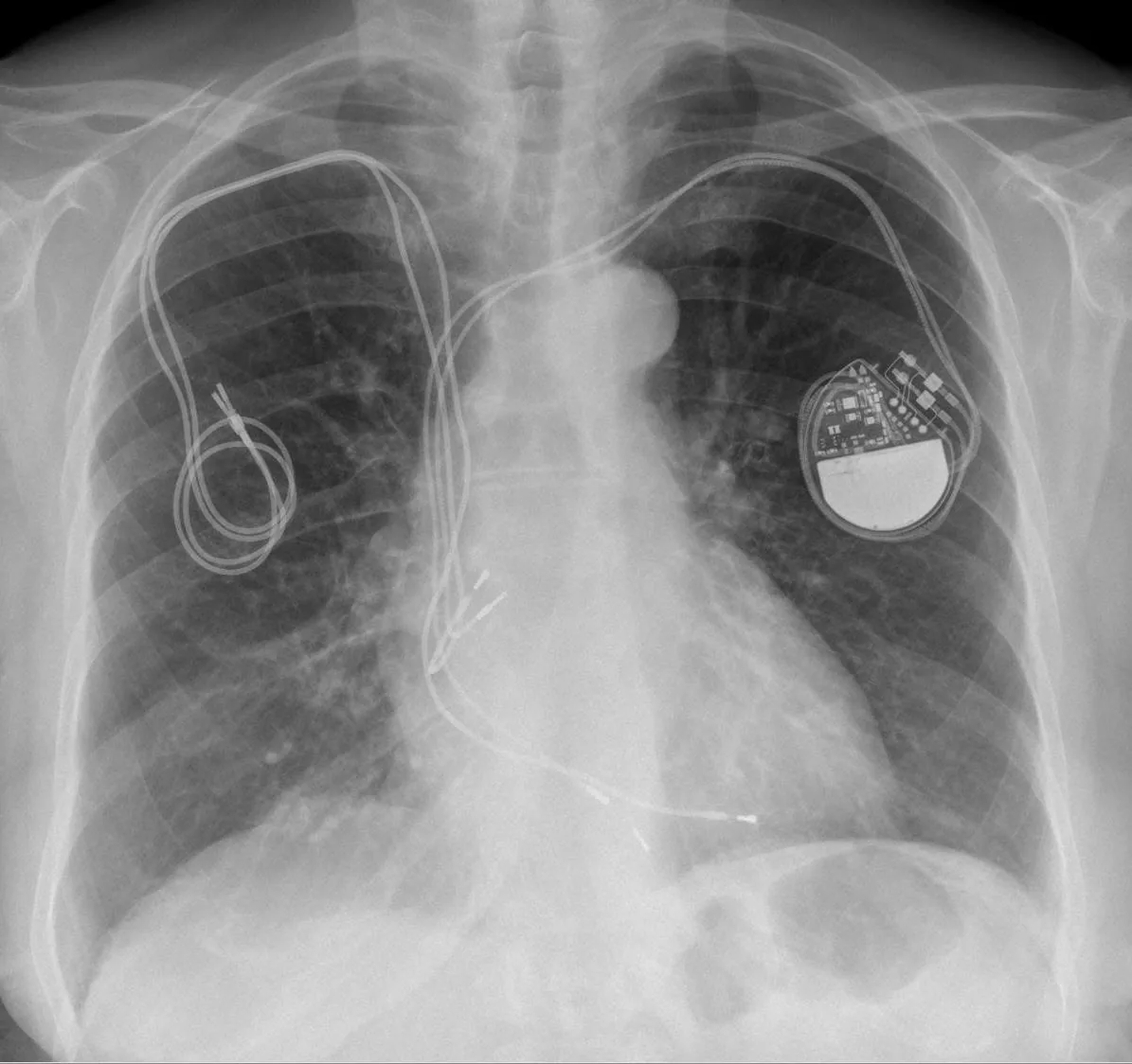 Lines & tubes radiograph for self-assessment