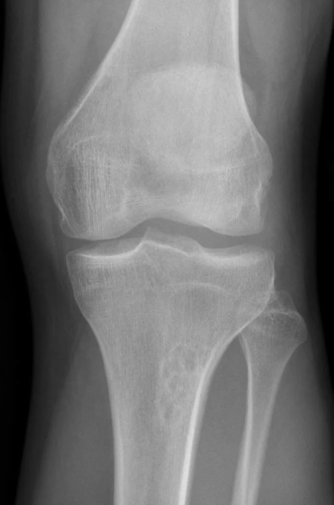 Bone & joint disease radiograph for self-assessment