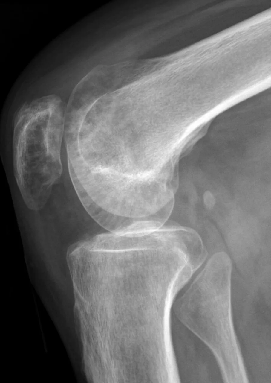 Bone & joint disease radiograph for self-assessment