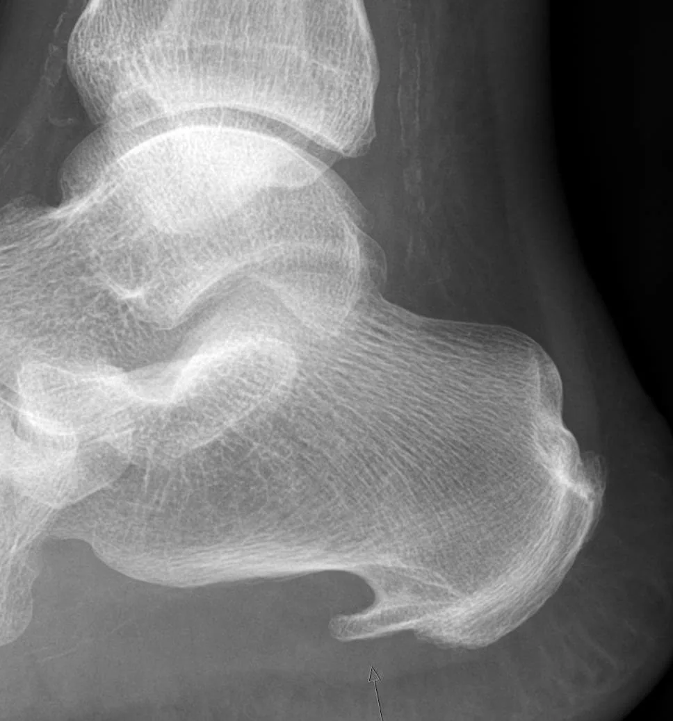 Lower limb radiograph for self-assessment