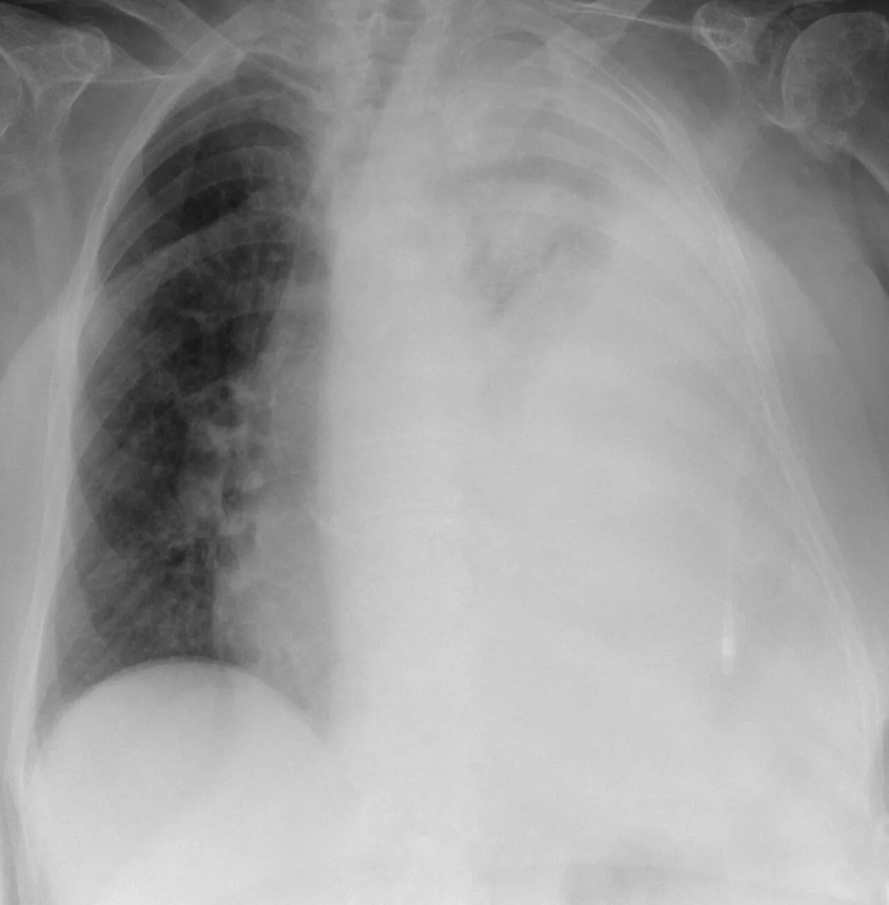 Chest radiograph for self-assessment