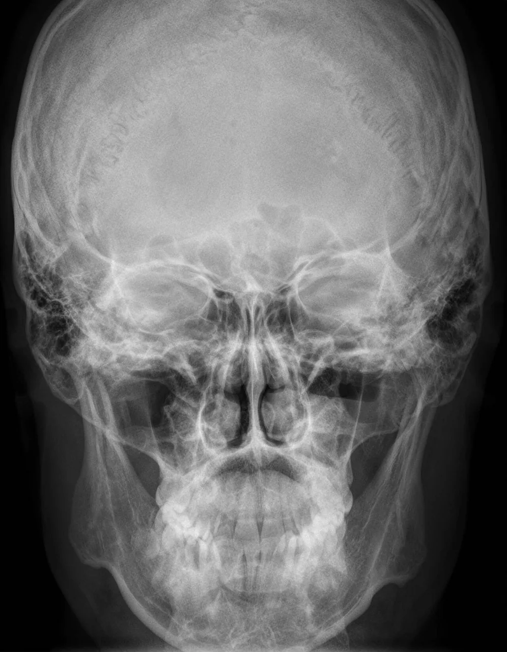 Skull & face radiograph for self-assessment