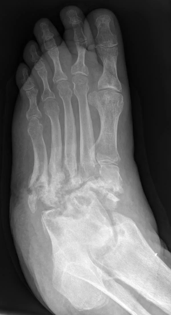 Bone & joint disease radiograph for self-assessment