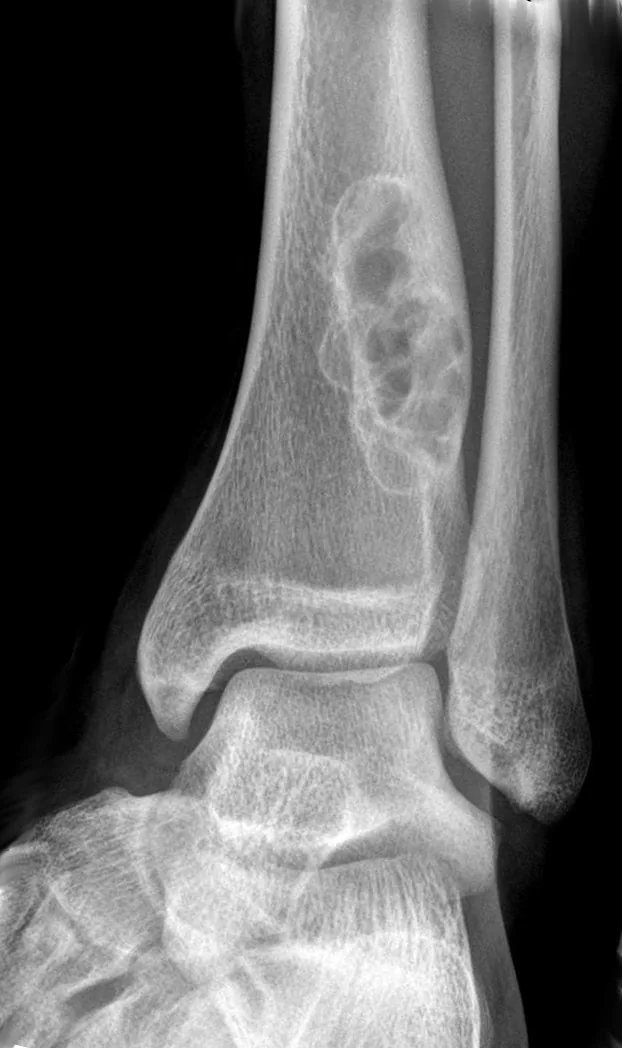 Bone & joint disease radiograph for self-assessment