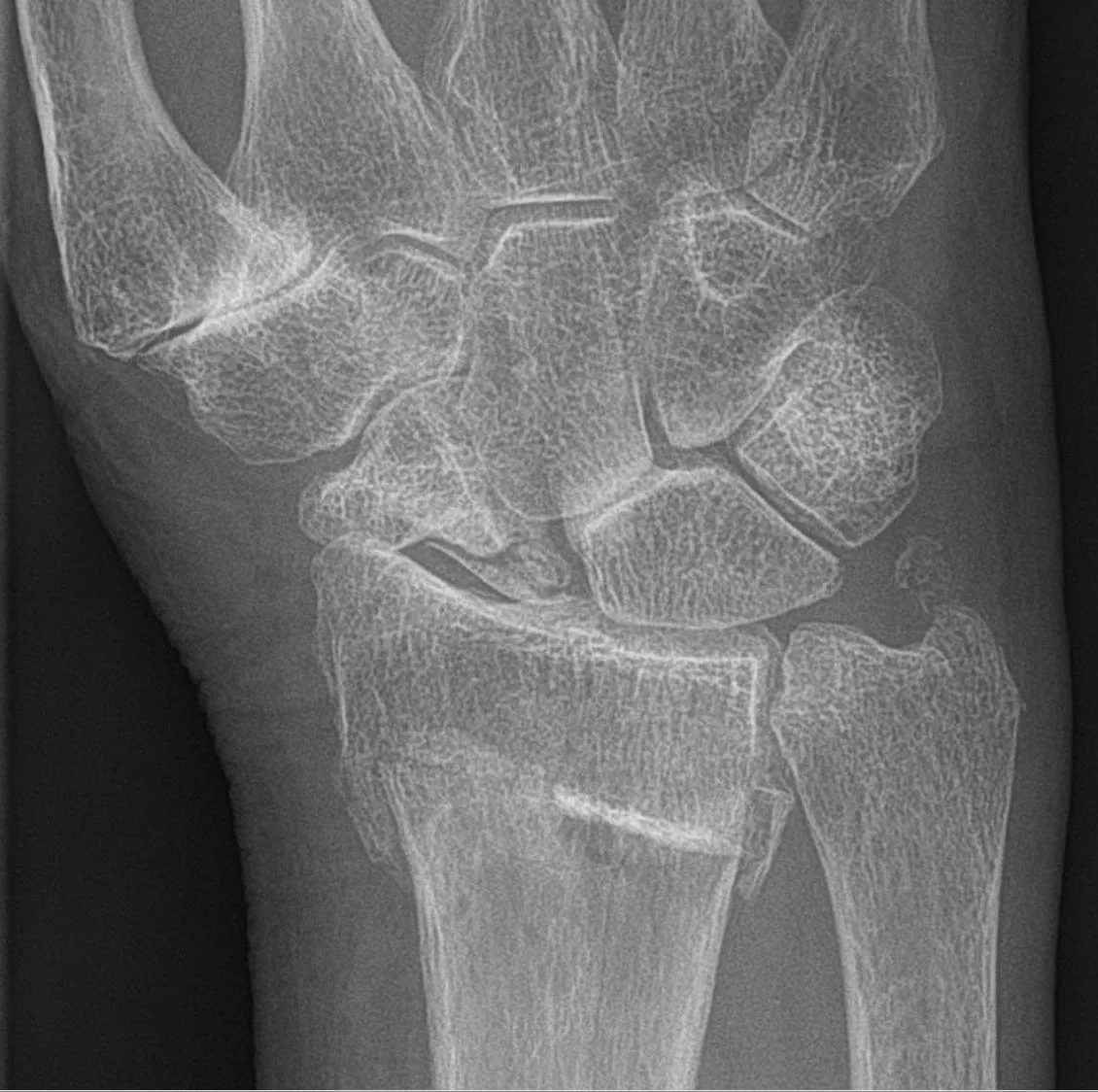 Bone & joint disease radiograph for self-assessment