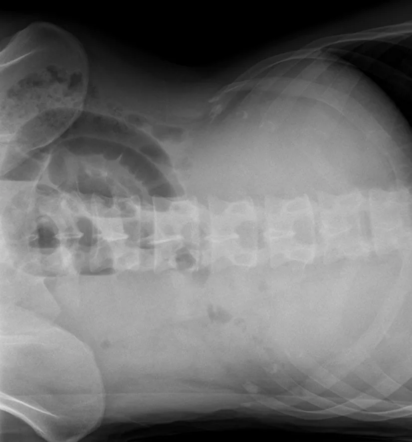 Abdomen radiograph for self-assessment