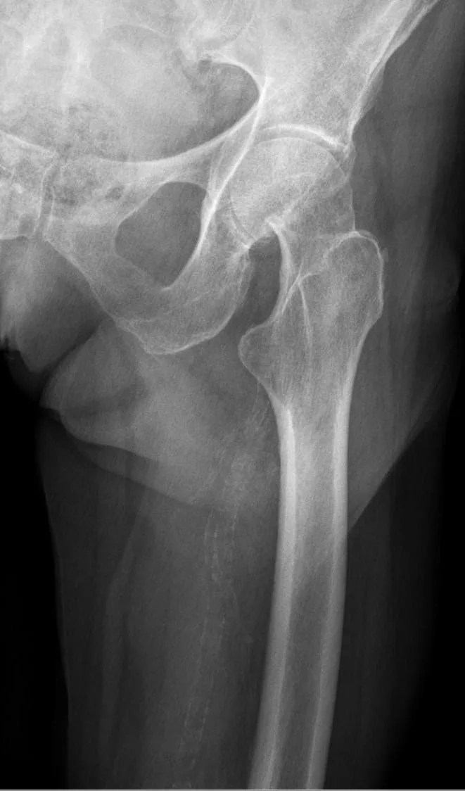 Lower limb radiograph for self-assessment