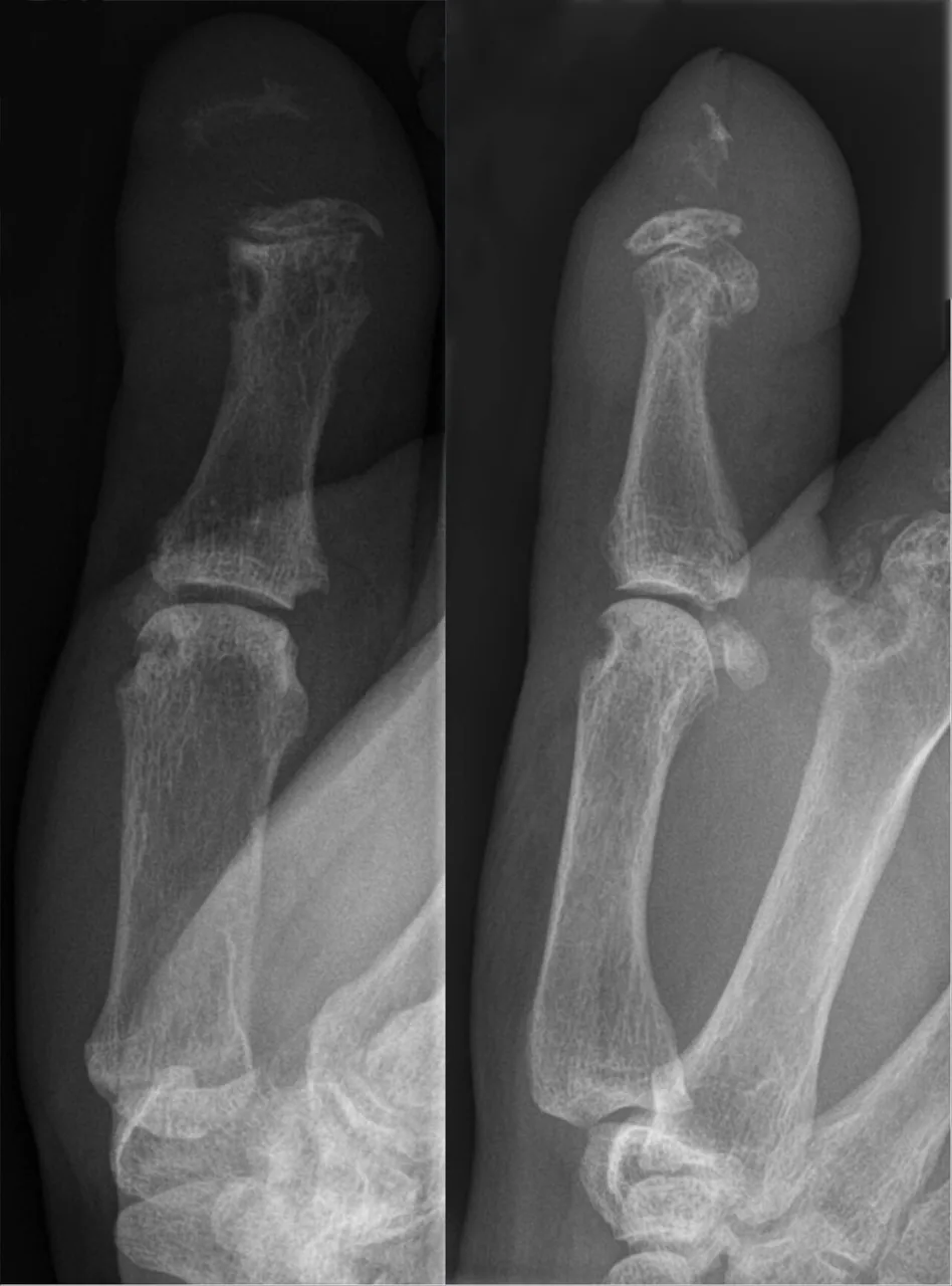 Bone & joint disease radiograph for self-assessment